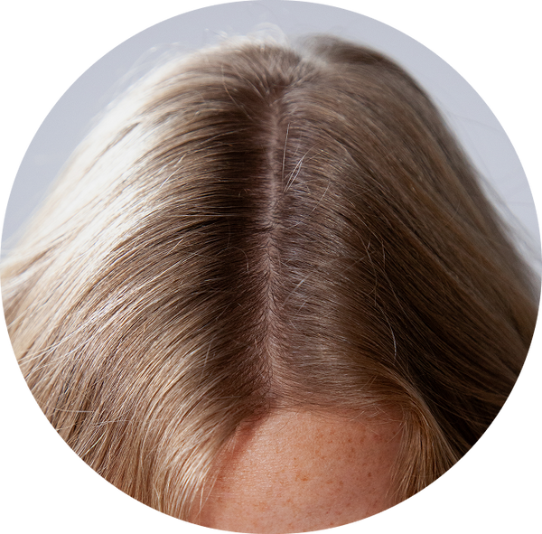 Apply the Follicle Drops step